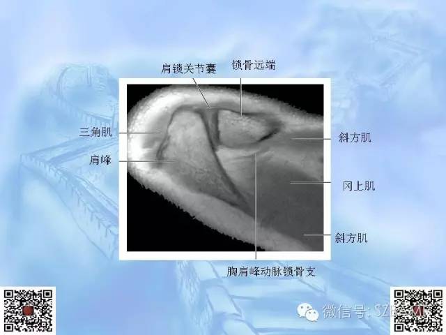 影像PPT - 【PPT】肩关节解剖-14