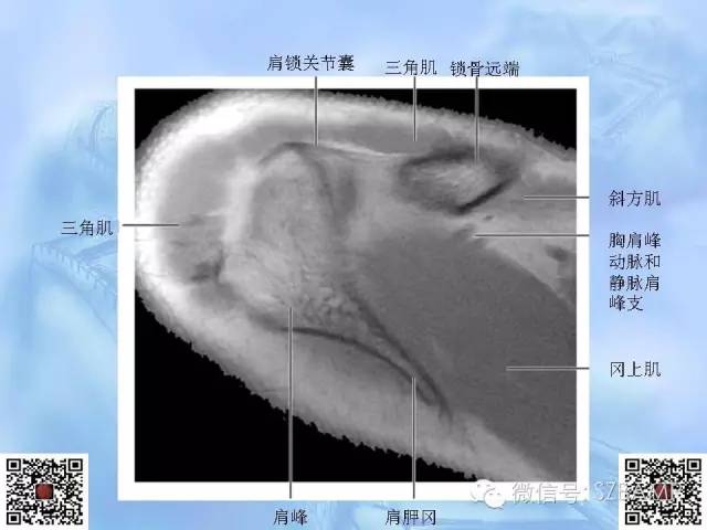 影像PPT - 【PPT】肩关节解剖-15