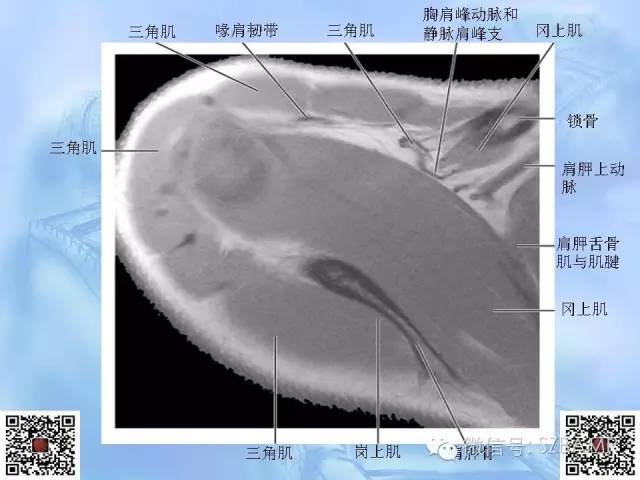 影像PPT - 【PPT】肩关节解剖-17