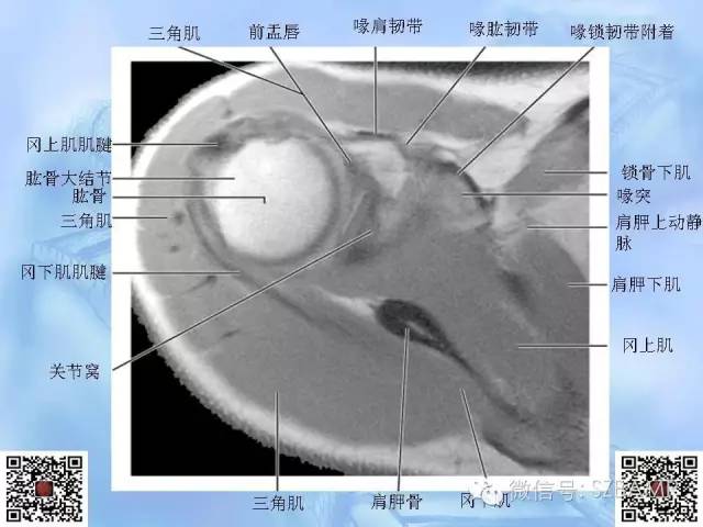 影像PPT - 【PPT】肩关节解剖-19
