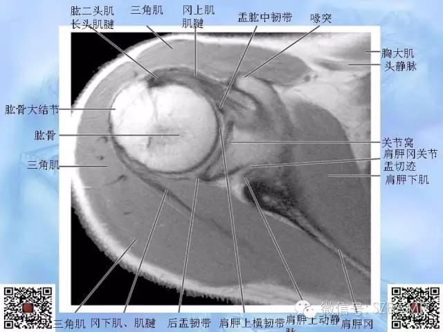 影像PPT - 【PPT】肩关节解剖-21