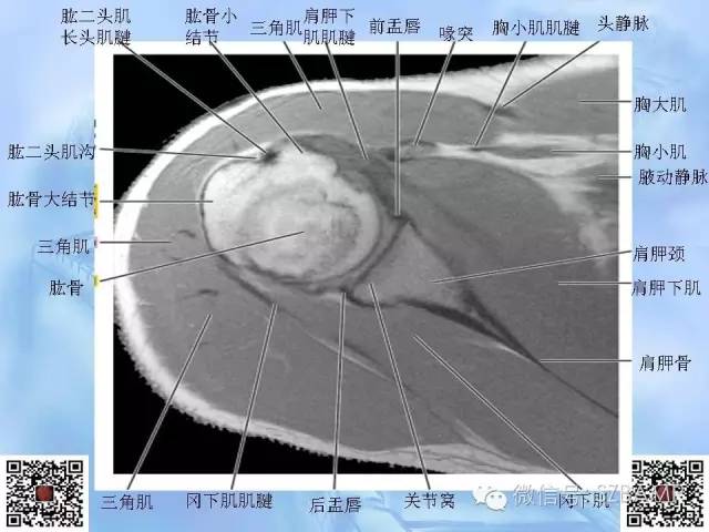 影像PPT - 【PPT】肩关节解剖-23