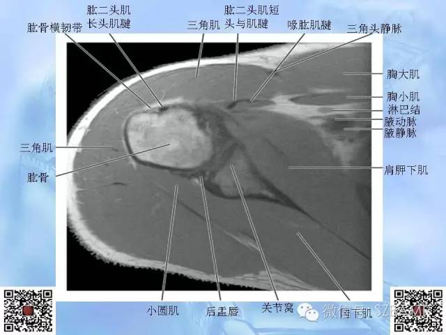 影像PPT - 【PPT】肩关节解剖-25