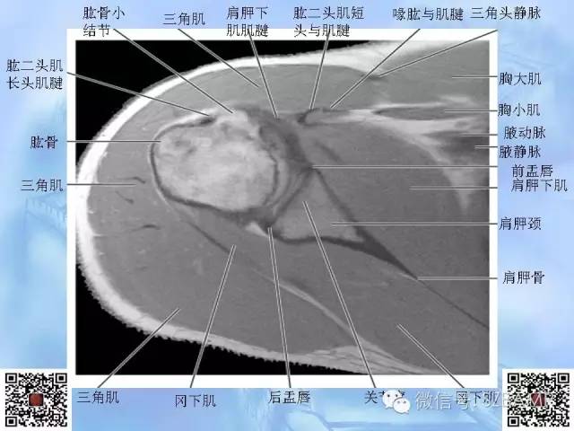 影像PPT - 【PPT】肩关节解剖-24