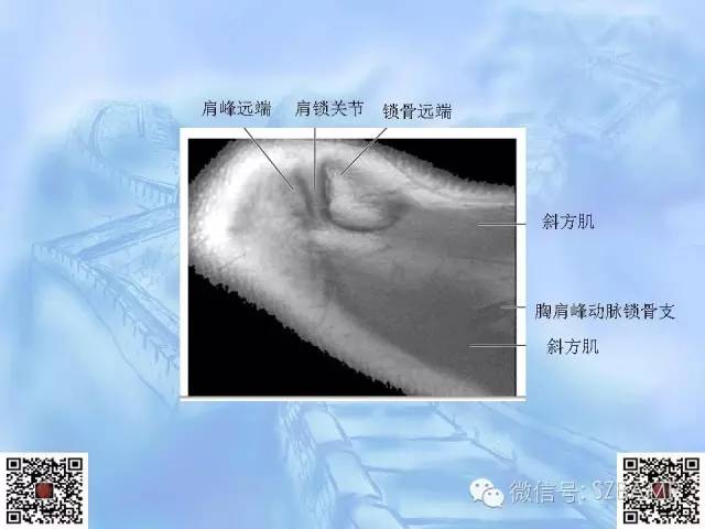 影像PPT - 【PPT】肩关节解剖-13
