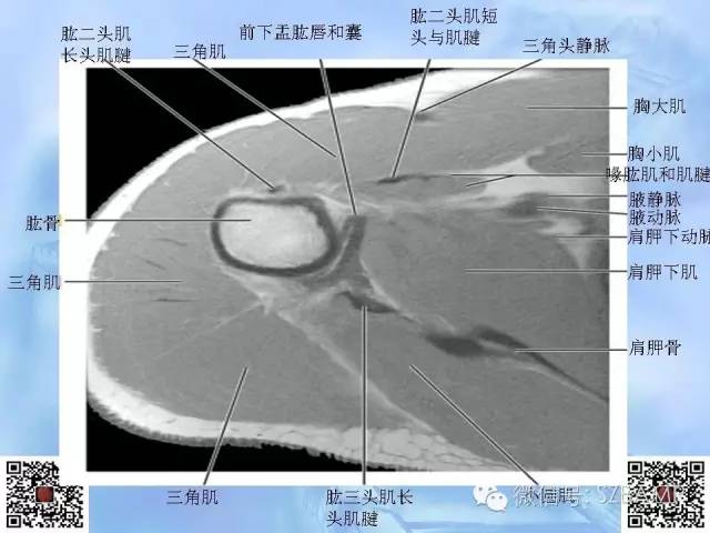 影像PPT - 【PPT】肩关节解剖-28