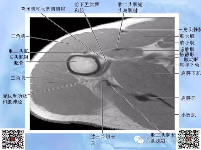 影像PPT - 【PPT】肩关节解剖-29