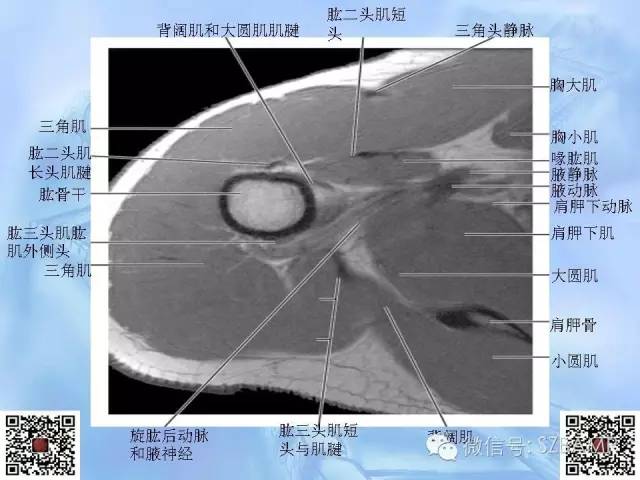 影像PPT - 【PPT】肩关节解剖-30
