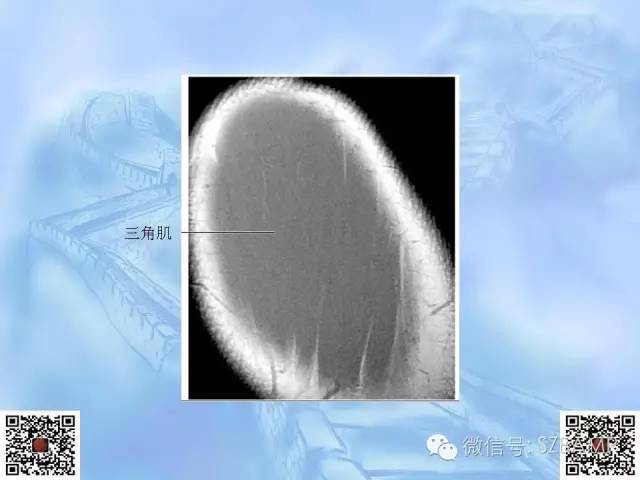 影像PPT - 【PPT】肩关节解剖-33