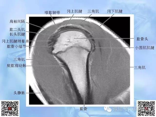 影像PPT - 【PPT】肩关节解剖-36