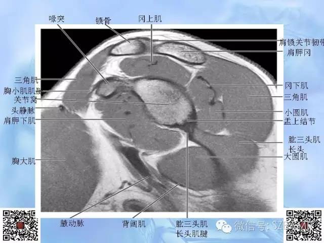 影像PPT - 【PPT】肩关节解剖-44
