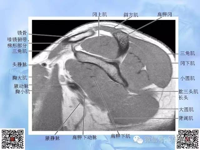 影像PPT - 【PPT】肩关节解剖-47