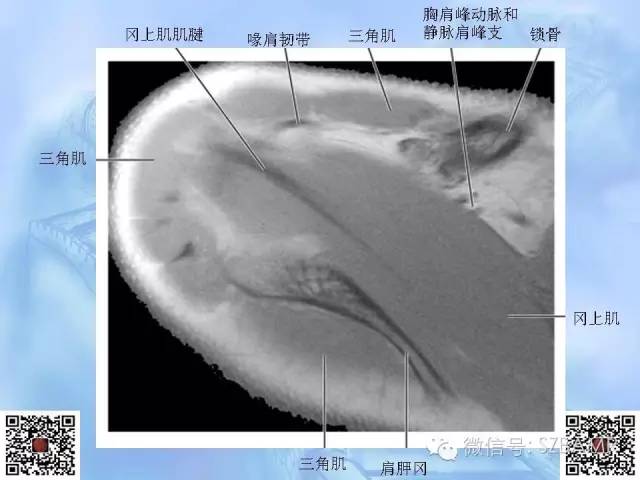 影像PPT - 【PPT】肩关节解剖-16