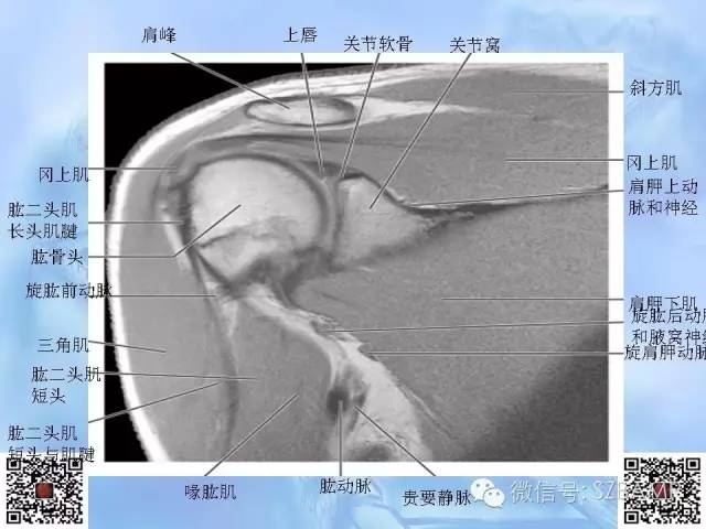 影像PPT - 【PPT】肩关节解剖-60