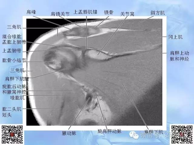 影像PPT - 【PPT】肩关节解剖-58