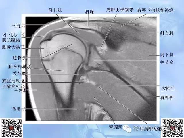 影像PPT - 【PPT】肩关节解剖-63