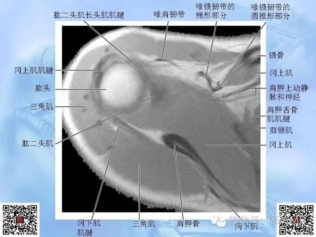 影像PPT - 【PPT】肩关节解剖-18