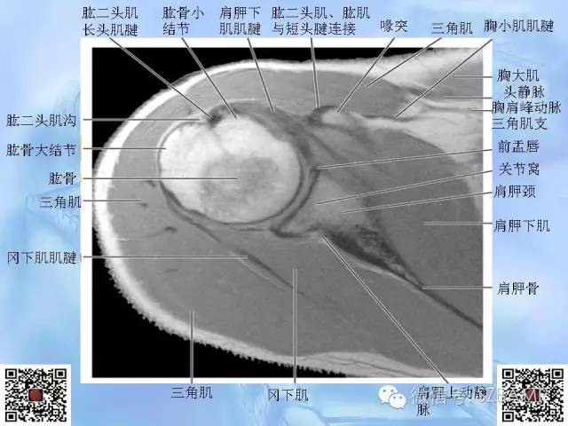 影像PPT - 【PPT】肩关节解剖-22