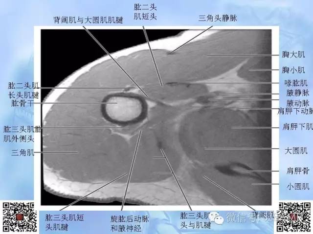 影像PPT - 【PPT】肩关节解剖-31