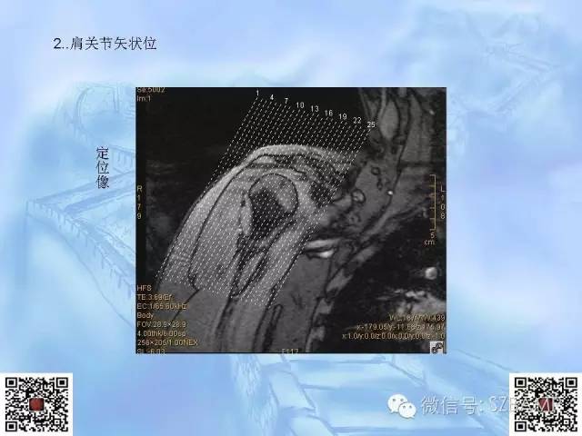 影像PPT - 【PPT】肩关节解剖-32