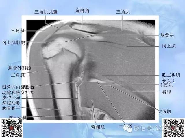 影像PPT - 【PPT】肩关节解剖-65