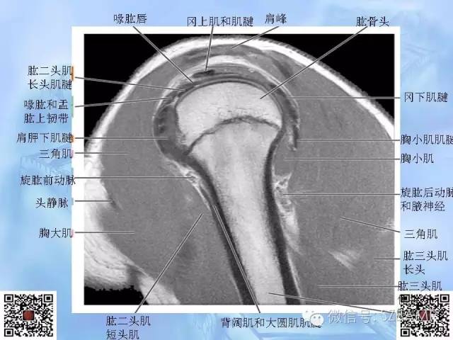 影像PPT - 【PPT】肩关节解剖-38