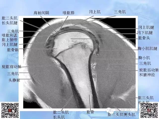 影像PPT - 【PPT】肩关节解剖-37