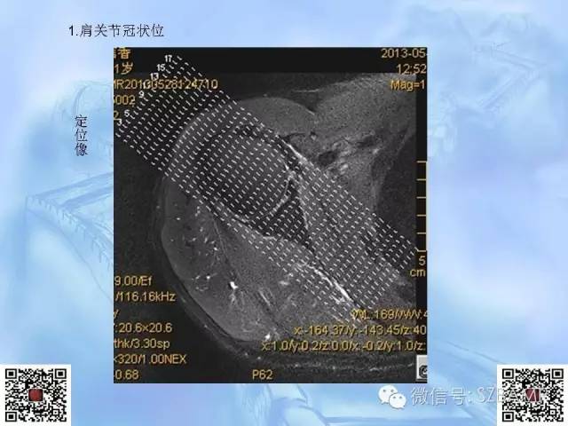 影像PPT - 【PPT】肩关节解剖-51