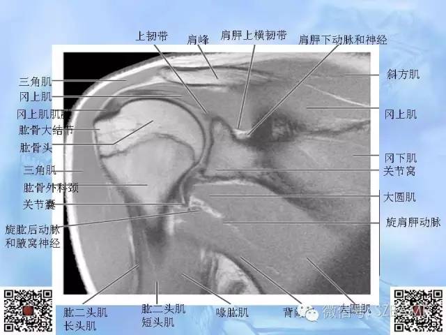 影像PPT - 【PPT】肩关节解剖-62