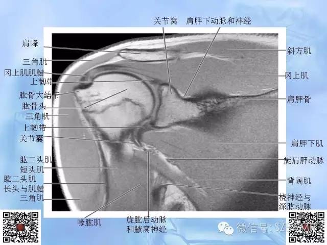 影像PPT - 【PPT】肩关节解剖-61