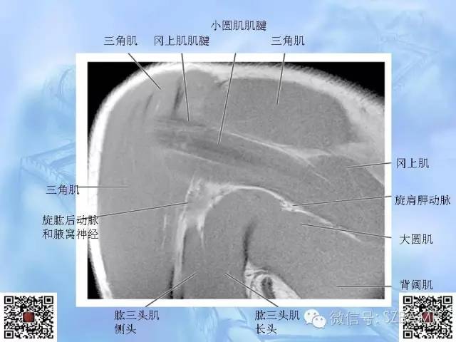 影像PPT - 【PPT】肩关节解剖-68