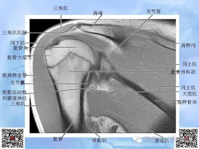 影像PPT - 【PPT】肩关节解剖-64