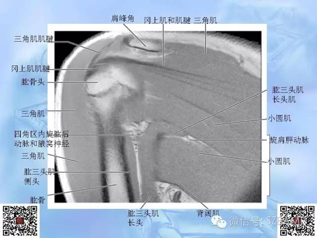 影像PPT - 【PPT】肩关节解剖-66