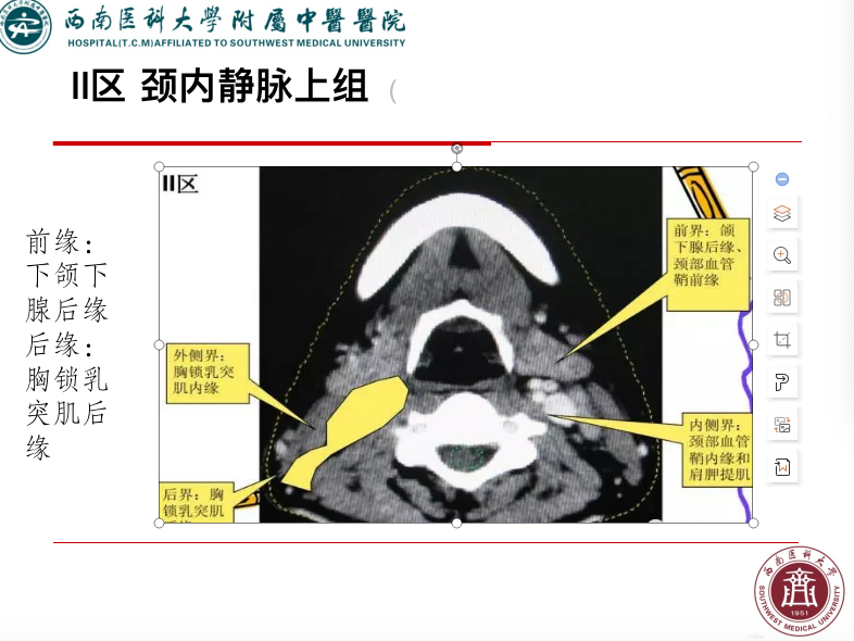 影像PPT - 【PPT】颈部淋巴结分区-13