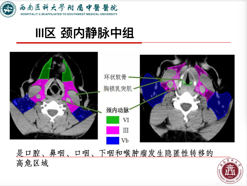 影像PPT - 【PPT】颈部淋巴结分区-17