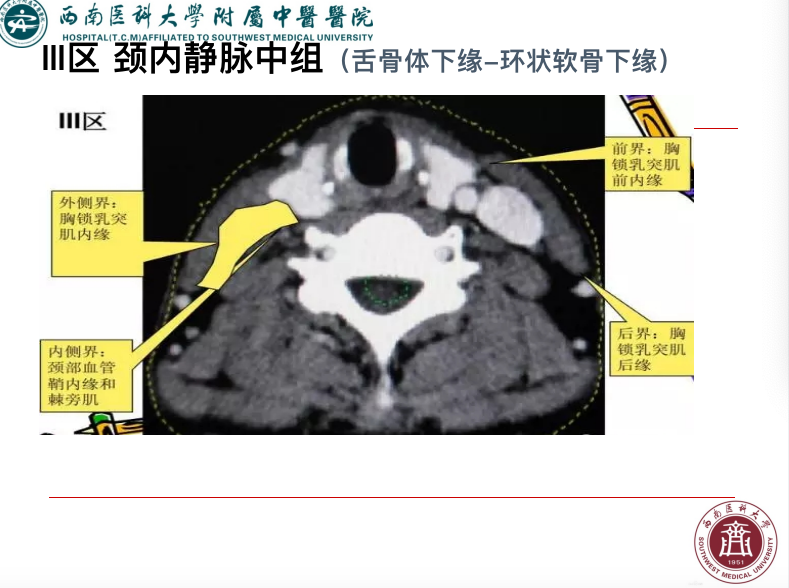 影像PPT - 【PPT】颈部淋巴结分区-16