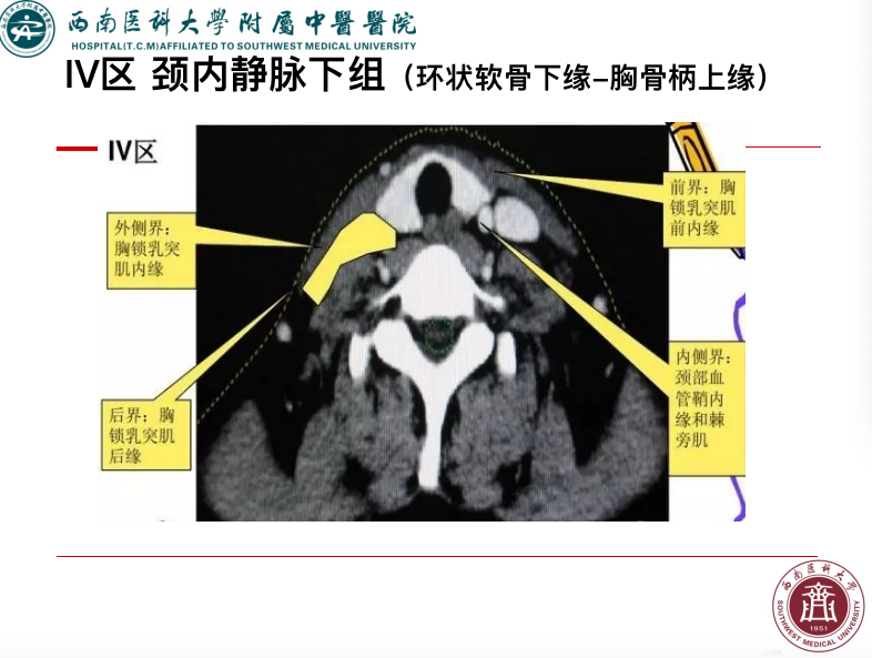 影像PPT - 【PPT】颈部淋巴结分区-19