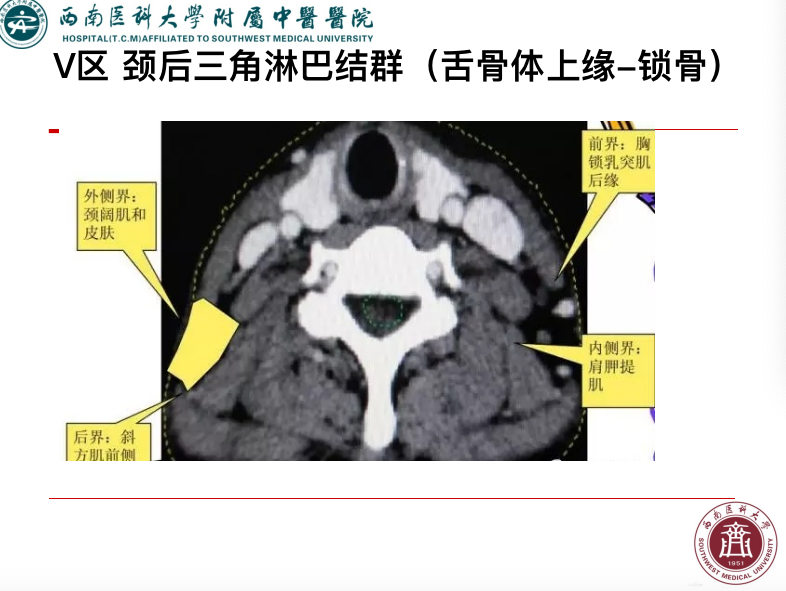 影像PPT - 【PPT】颈部淋巴结分区-23