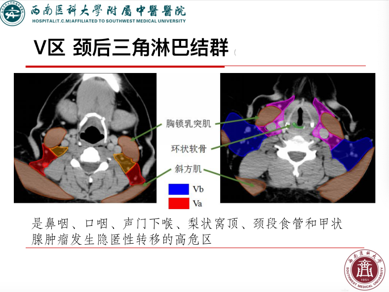 影像PPT - 【PPT】颈部淋巴结分区-25