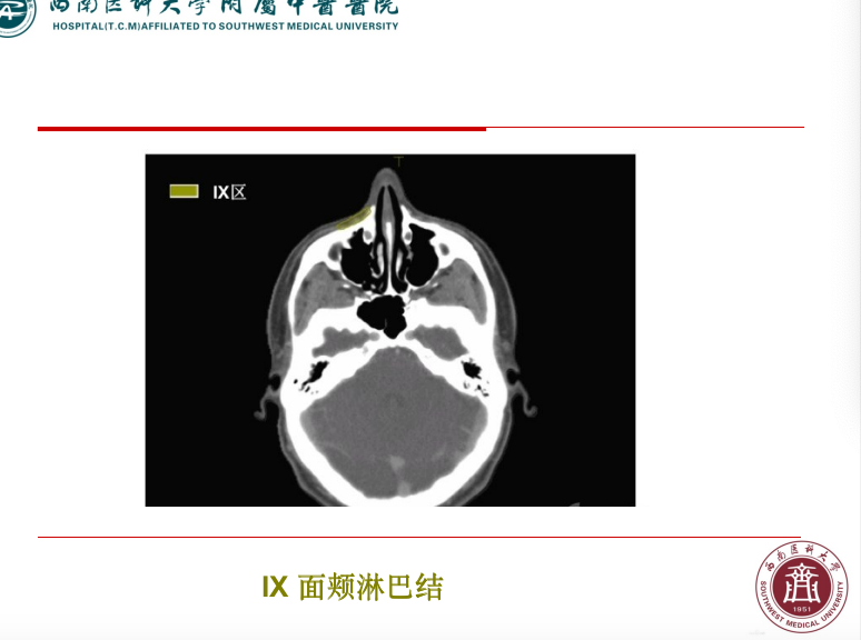 影像PPT - 【PPT】颈部淋巴结分区-33