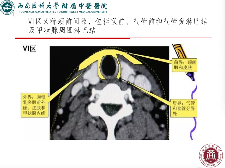 影像PPT - 【PPT】颈部淋巴结分区-27