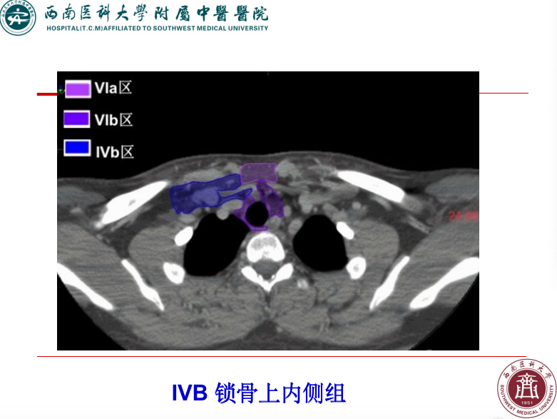 影像PPT - 【PPT】颈部淋巴结分区-38