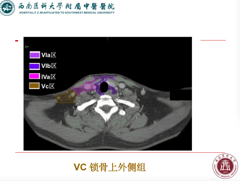 影像PPT - 【PPT】颈部淋巴结分区-37