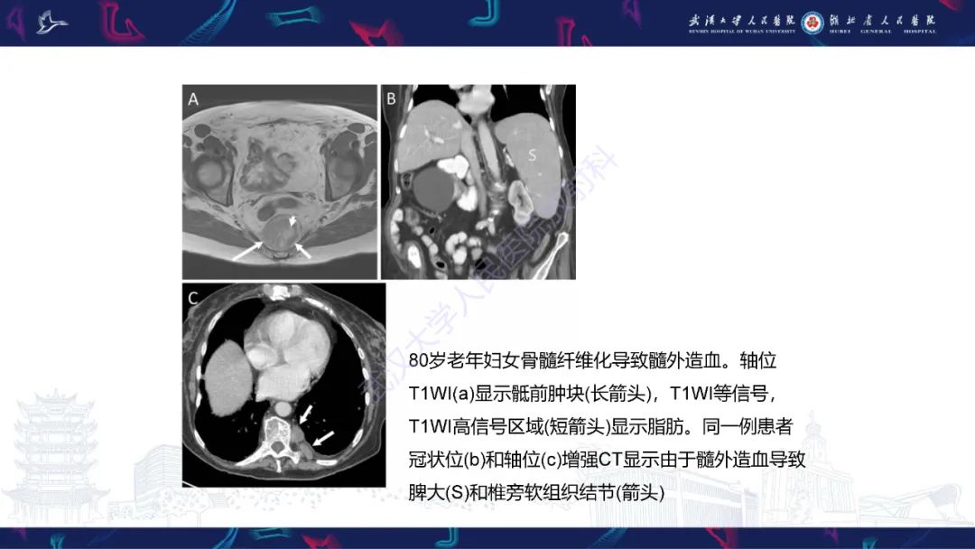 影像PPT - 【PPT】女性盆腔含脂肪病变影像诊断-29