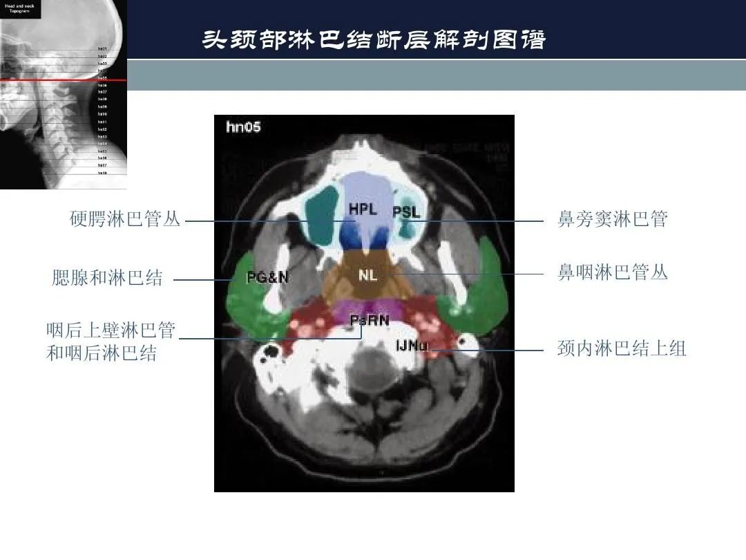 影像PPT - 【PPT】淋巴结引流的断层解剖与影像学分区-4