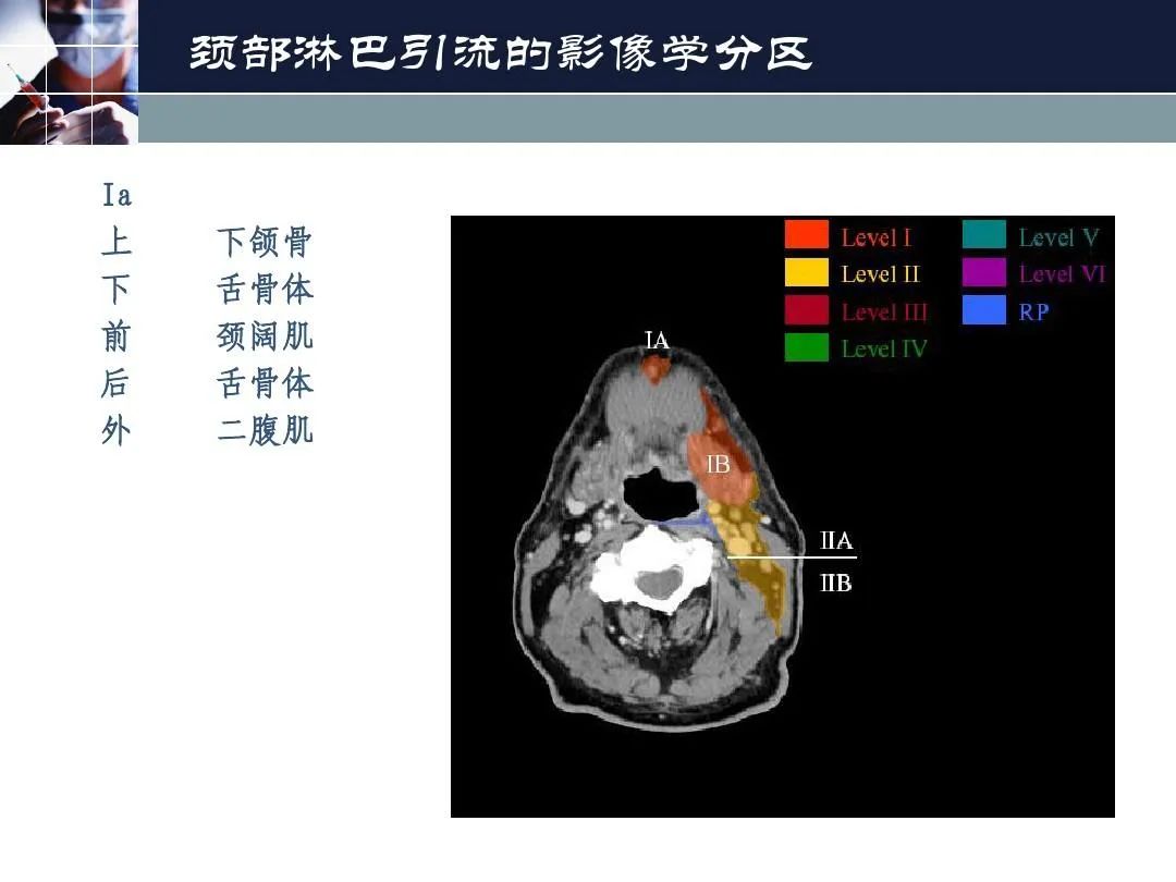 影像PPT - 【PPT】淋巴结引流的断层解剖与影像学分区-7