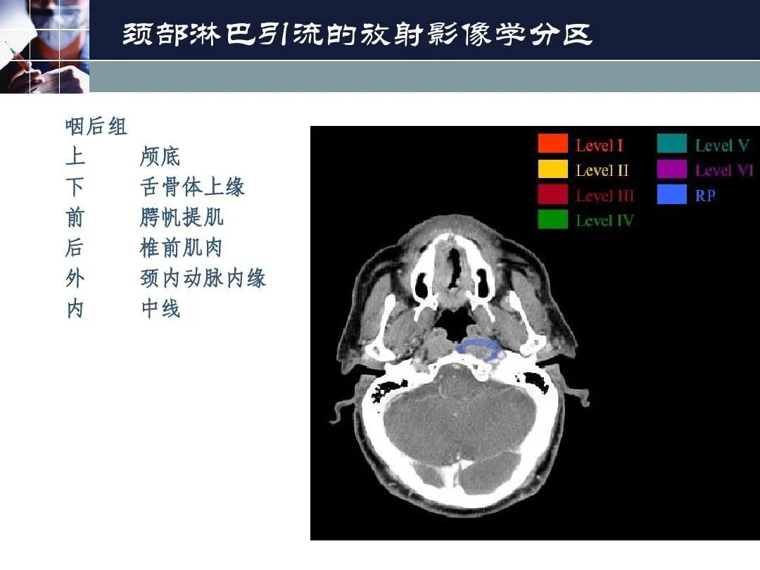 影像PPT - 【PPT】淋巴结引流的断层解剖与影像学分区-5