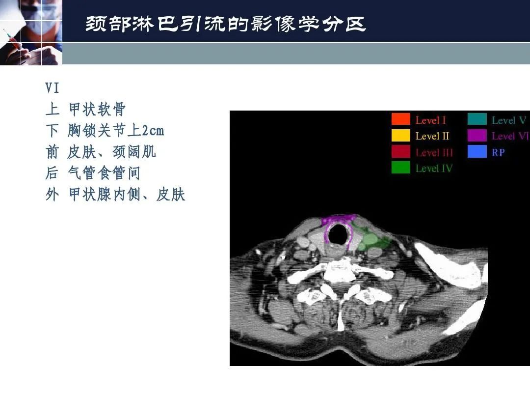 影像PPT - 【PPT】淋巴结引流的断层解剖与影像学分区-12
