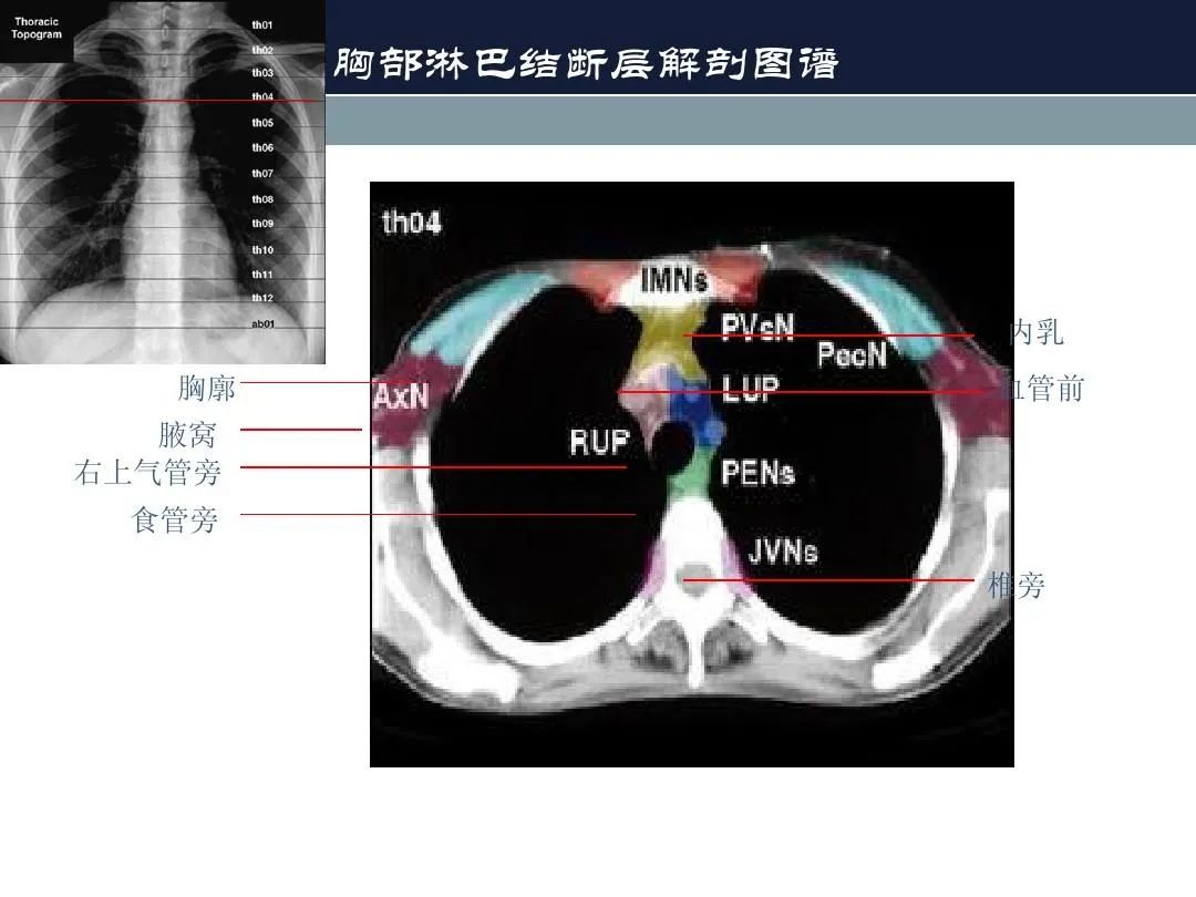 影像PPT - 【PPT】淋巴结引流的断层解剖与影像学分区-16