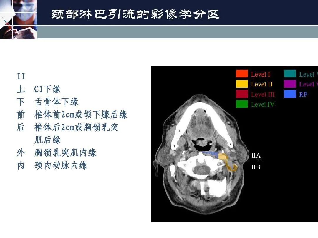 影像PPT - 【PPT】淋巴结引流的断层解剖与影像学分区-6